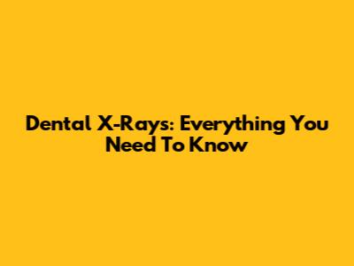 Dental X-Rays: Everything You Need To Know