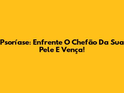 Psoríase: Enfrente O Chefão Da Sua Pele E Vença!
